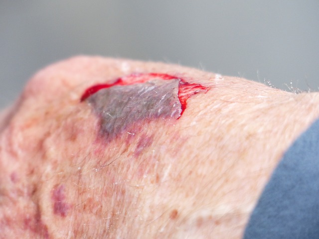 Get What You Need When Dealing With A Personal Injury