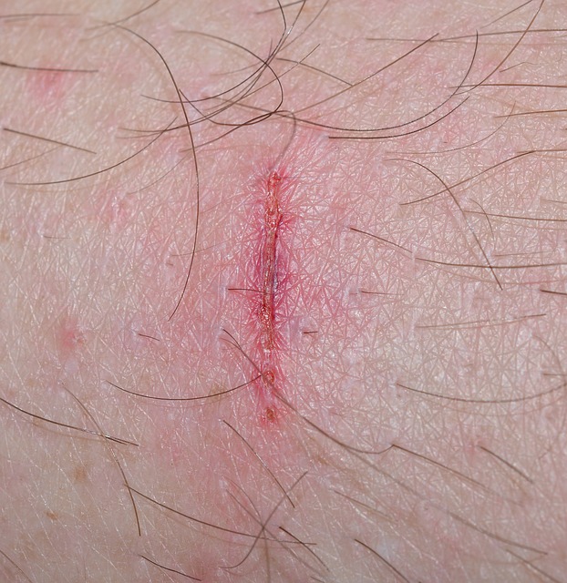 Personal Injury Tips That Can Make A Big Difference