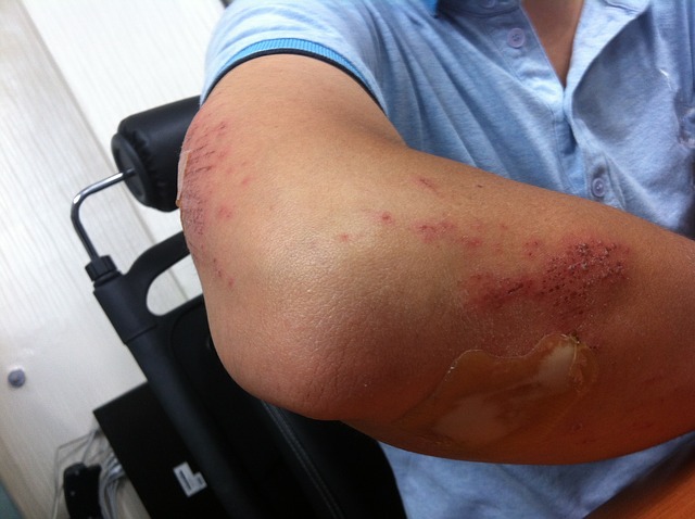 Injured? How To Deal With The Law