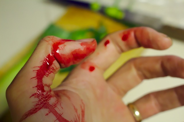 A Few Steps Towards Finding Personal Injury Case Success
