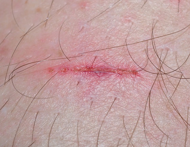 Solid Advice For Dealing With Personal Injury Lawyers