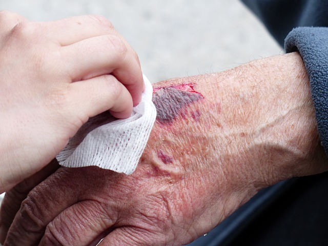 Top Tips For Navigating A Personal Injury Claim!