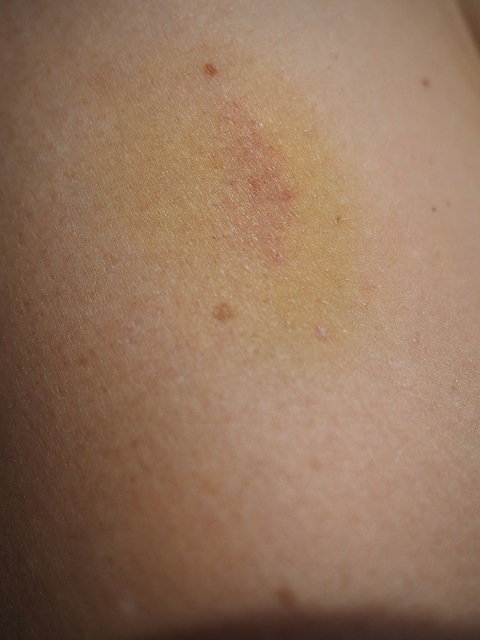 You Must Read This If You Have A Personal Injury