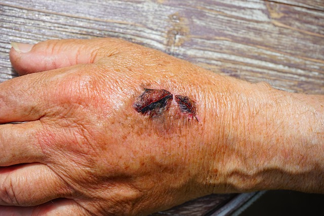 Information You Need To Know About Personal Injury