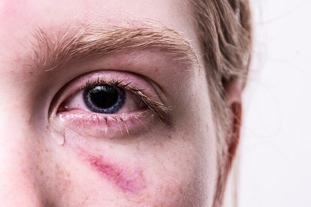 Find The Personal Injury Attorney That Will Work For You