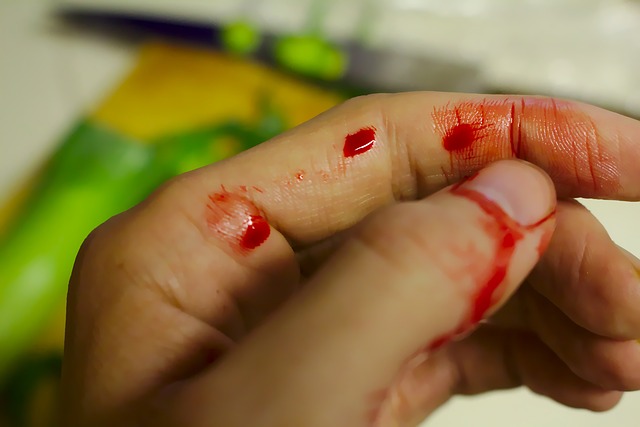 If You Need Help With Personal Injury Issues Then The Following Article Is Just For You!