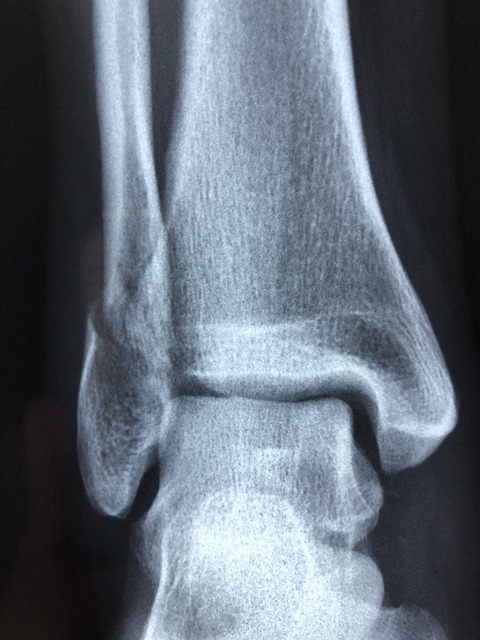 Cool Personal Injury Tips You Should Know About