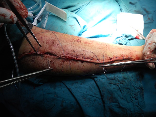 Effective Advice On Dealing With Legal Issues Regarding Personal Injury