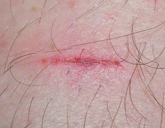 Useful Tips To Help You With Personal Injury Law