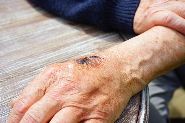 Legal Advice For Your Personal Injury Dilemma