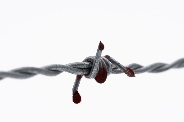 Ideas About Personal Injury Are Very Easy When You’ve Got Great Tips!