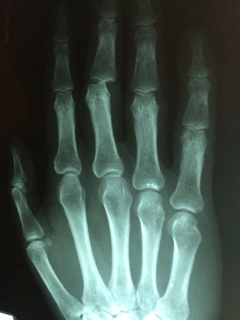 Good Tips On How To Handle An Injury