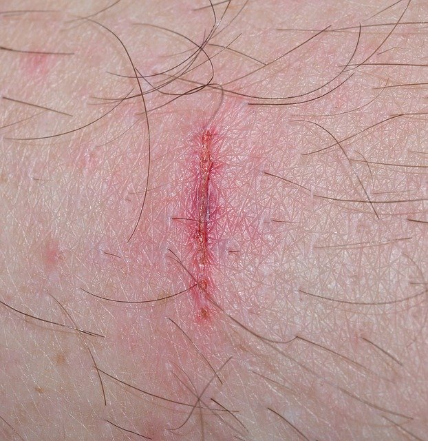 All The Very Best Ideas About Personal Injury Are Right Below