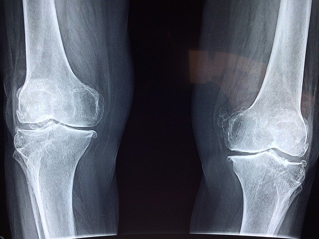 Expert Personal Injury Tips To Help You Out