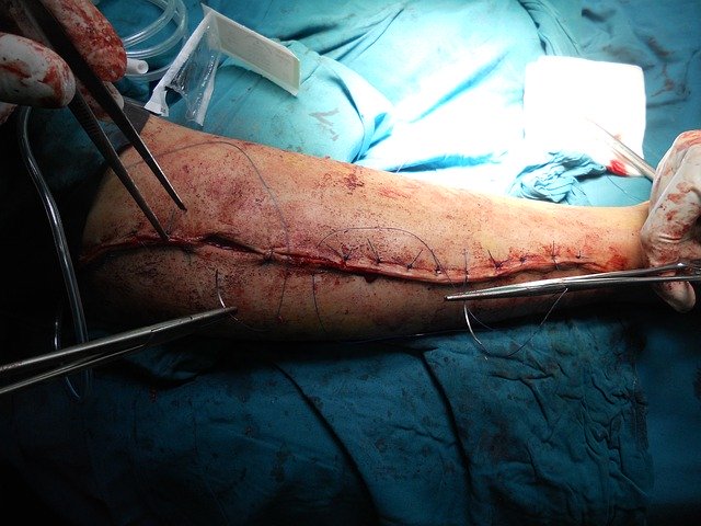A Helpful Article About Personal Injury That Offers Many Useful Tips