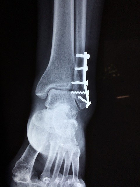 Do You Have A Personal Injury Case?