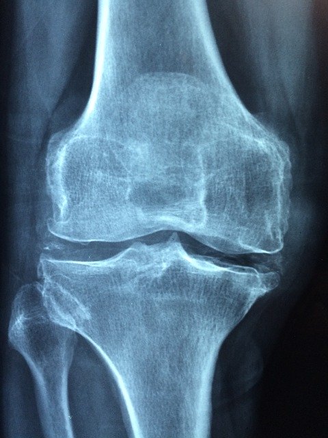 Look Below And You Will Find Positive Information About Personal Injury