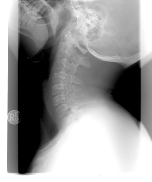 Helping You Get A Better Understanding About Personal Injury With Simple Tips